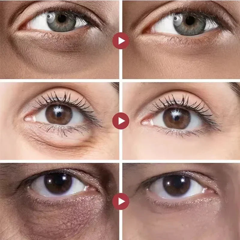 Rolon 5 em 1 Ultra Rejuvenescedor Luteína Inova® PAGUE 1 LEVE 3 (com entrega relâmpago ⚡)